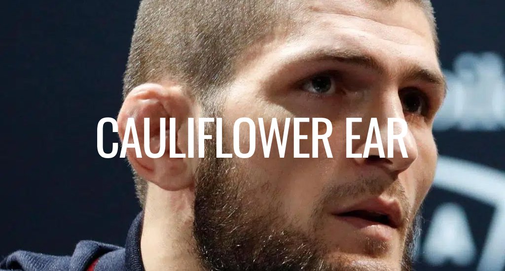 Is Cauliflower Ear Dangerous?